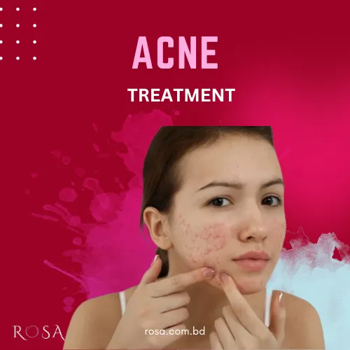 Acne Products category rosa cosmetics shop
