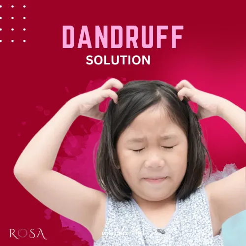 Hair Dandruff solution rosa cosmetics shop